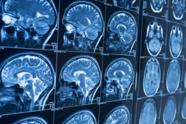 Emmanuelle Wilhelm studies are based on the human brain ©UCL Emmanuelle Wilhelm studies are based on the human brain ©UCL